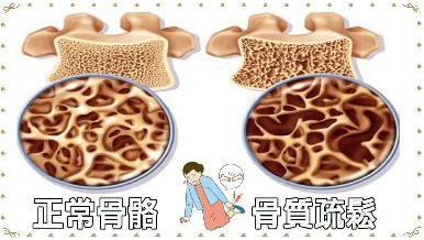 GK-7000骨密度仪器生产厂家国康主张喝牛奶能防骨质疏松