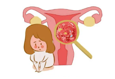 全自动阴道分泌物检测仪品牌介绍哪些女性需要做白带常规检查