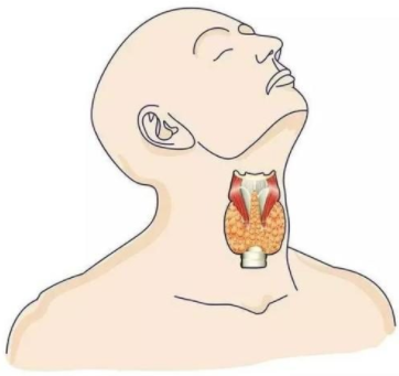 尿碘分析仪厂家提示这几类甲状腺疾病需引起大家重视