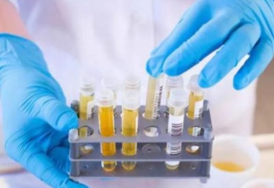 尿碘分析仪厂家解读怀孕期间进行尿碘检查意义大不大